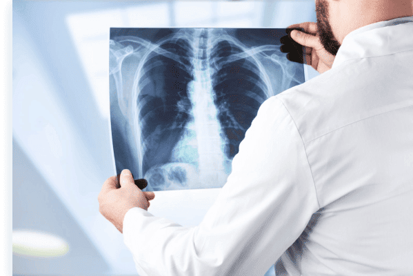 Скидка 20% на флюорографию